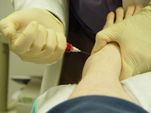 PRP procedūra